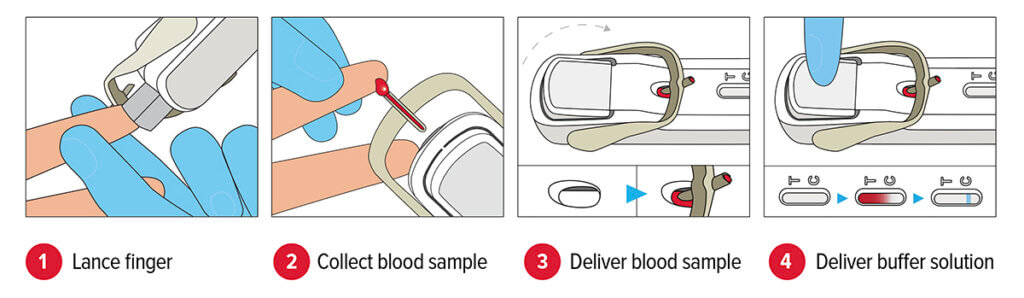 Amiry & Gilbride Pharmacy FebriDx Virus Bacteria Test